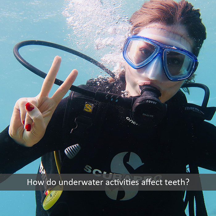 underwater-teeth-2022_700.jpg
